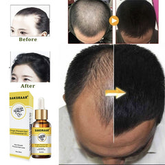 Hair Loss Products